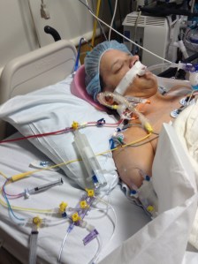 Post double-lung transplant IMG_2993